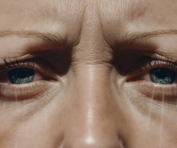 Hoofdpijn bij het ontwaken bekijk de oorzaken zoals slaaptekort en alle oplossingen nu